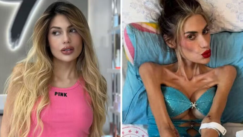 Luto na internet: influenciadora turca Nihal Candan morre aos 30 anos vítima de anorexia