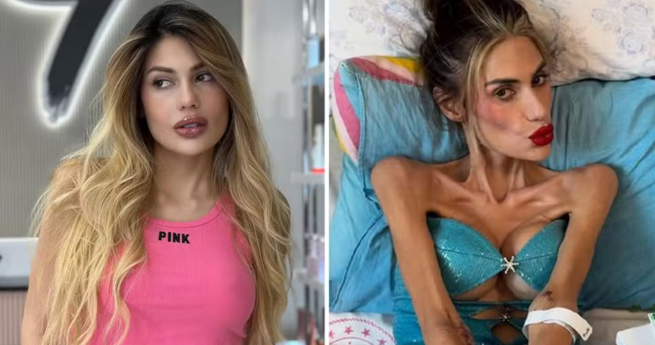 Luto na internet: influenciadora turca Nihal Candan morre aos 30 anos vítima de anorexia