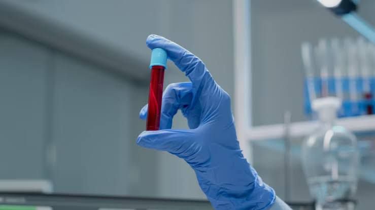 Japão desenvolve sangue artificial universal que pode revolucionar a medicina