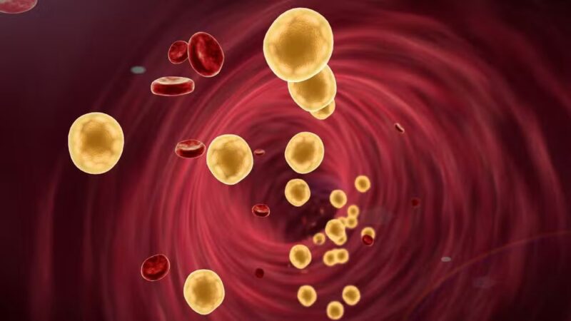 Nova diretriz de cardiologia endurece metas para colesterol no Brasil