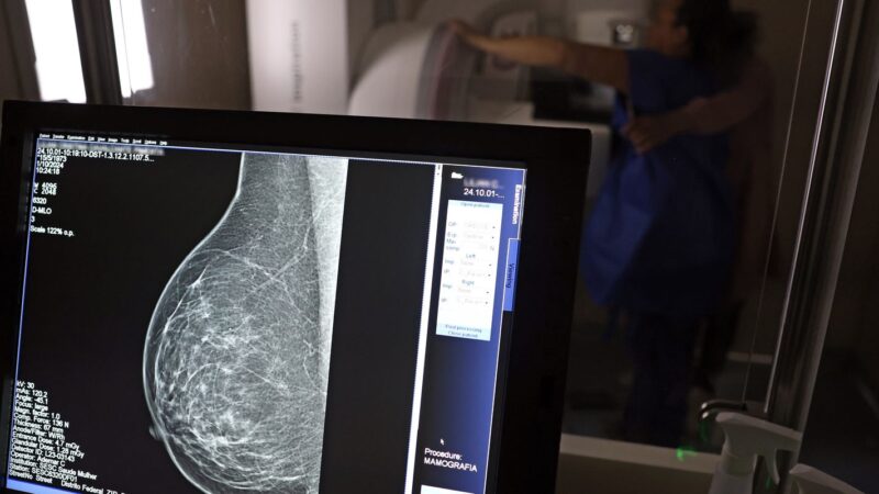 Outubro Rosa: mulheres com câncer de mama podem solicitar auxílio-doença e outros benefícios previdenciários