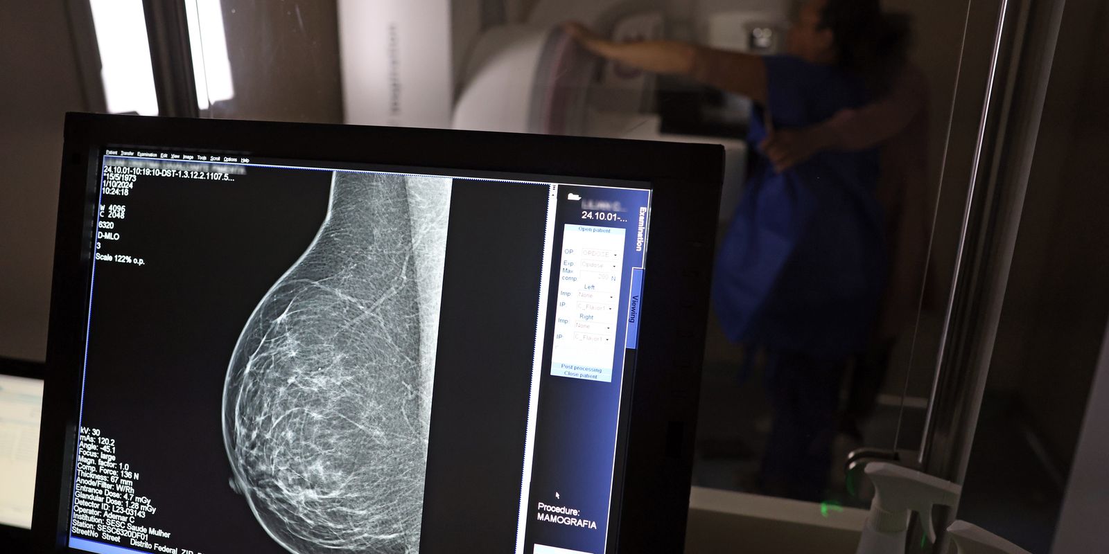 Outubro Rosa: mulheres com câncer de mama podem solicitar auxílio-doença e outros benefícios previdenciários