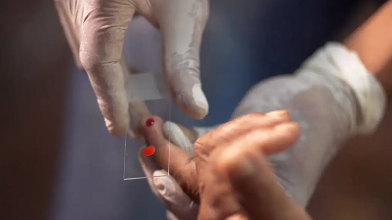 SUS passa a oferecer novo tratamento contra malária para crianças