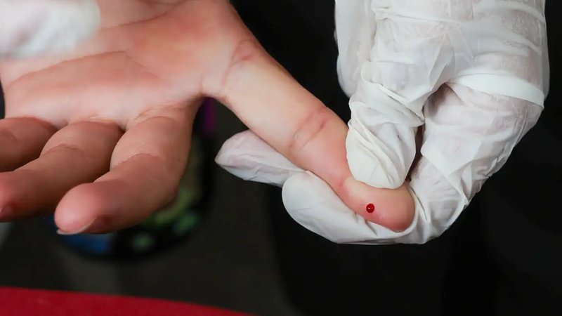 Teste rápido de dengue passa a ser oferecido pelo SUS