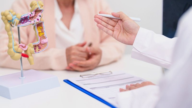 SUS passa a oferecer teste para rastreamento do câncer colorretal
